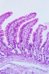 Intestines